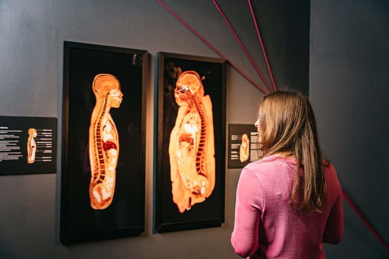 Berlin: Tickets for the BODY WORLDS Museum in Berlin - What is included, and what costs extra